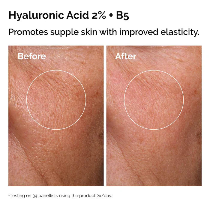The Ordinary 
The Skin Support Set with Niacinamide + Hyaluronic