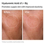 The Ordinary 
The Skin Support Set with Niacinamide + Hyaluronic