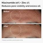 The Ordinary 
The Skin Support Set with Niacinamide + Hyaluronic