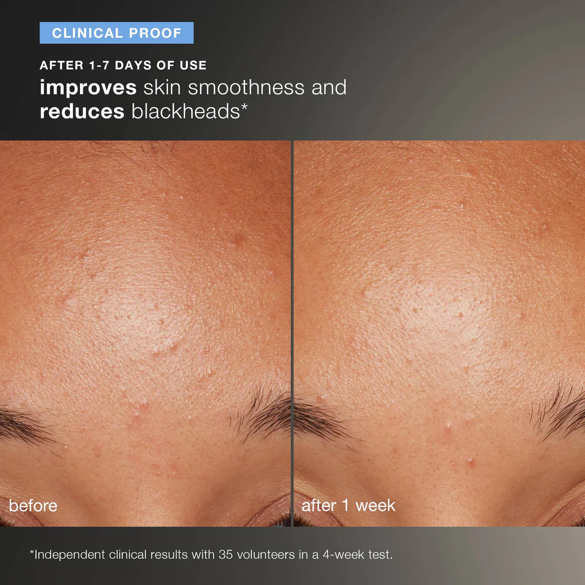 Dermalogica daily microfoliant exfoliator