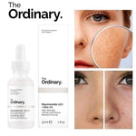 the ordinary niacinamide 10% + zinc 1% serum